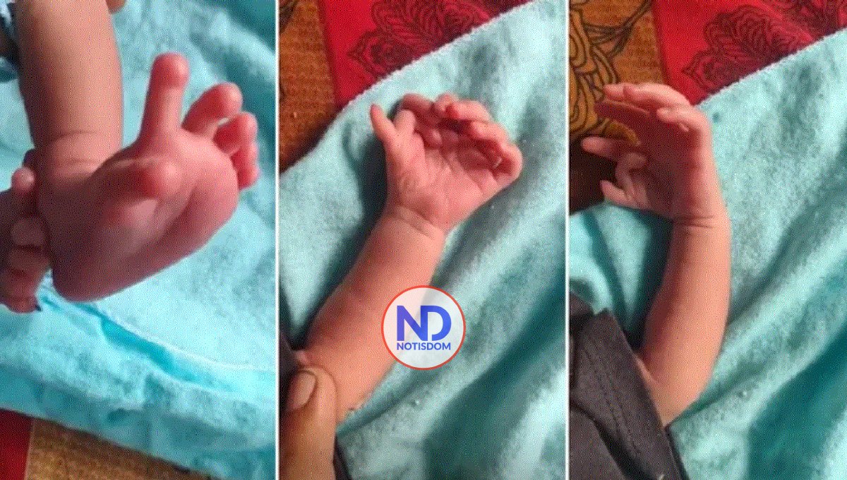 Bebé nace con 26 dedos en India y padres creen que es reencarnación de una deidad