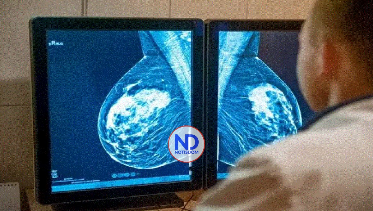 Innovación mejora expectativa de vida en pacientes de cáncer de mama metastásico