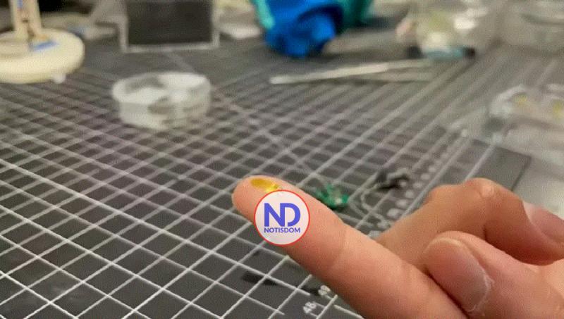 Diseñan un pequeño dispositivo para vigilar un riñón trasplantado