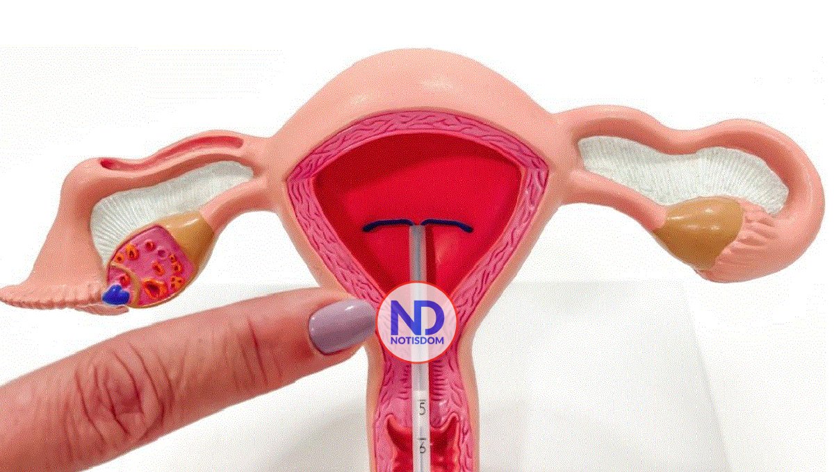 ¿Es un inconveniente ponerse el DIU con el periodo?