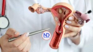 Nueva prueba para detectar cáncer de útero