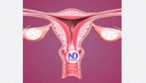 Tengo 9 días con un sangrado muy frecuente ¿Qué podría ser?