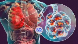 ¿Qué es la neumonía y por qué se celebra a nivel mundial el 12 de noviembre?