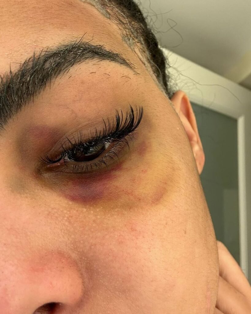 yailin 20 Salen a la luz nuevas fotos de Yailin La Más Viral golpeada