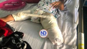Tras ser amputada de una pierna, una niña adquiere una bacteria en hospital