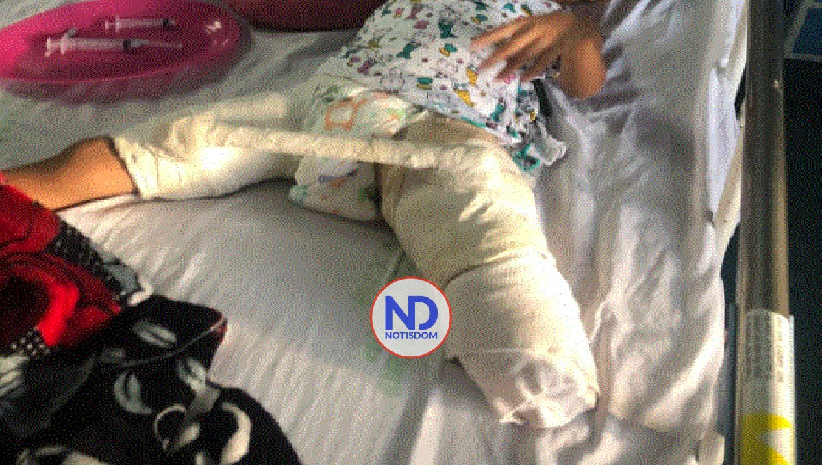 Tras ser amputada de una pierna, una niña adquiere una bacteria en hospital 2 Tras ser amputada de una pierna, una niña adquiere una bacteria en hospital