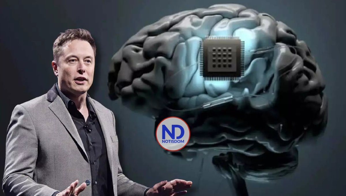 Cómo funciona chip cerebral de Elon Musk que controla dispositivos con el pensamiento 2 Cómo funciona chip cerebral de Elon Musk que controla dispositivos con el pensamiento