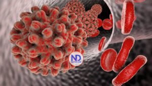 Casos de hepatitis B aumentan en Nueva York, en su mayoría en vecindarios pobres