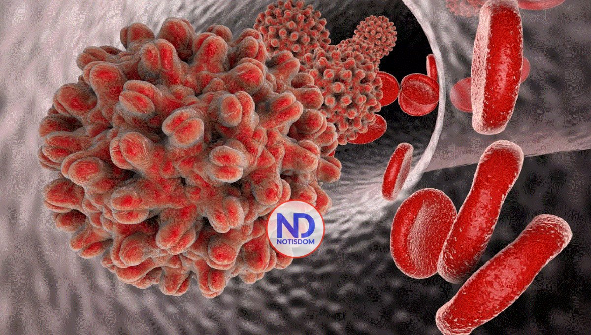 Casos de hepatitis B aumentan en Nueva York, en su mayoría en vecindarios pobres