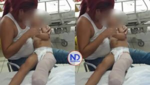 Accidente entre motores deja a una niña sin pierna