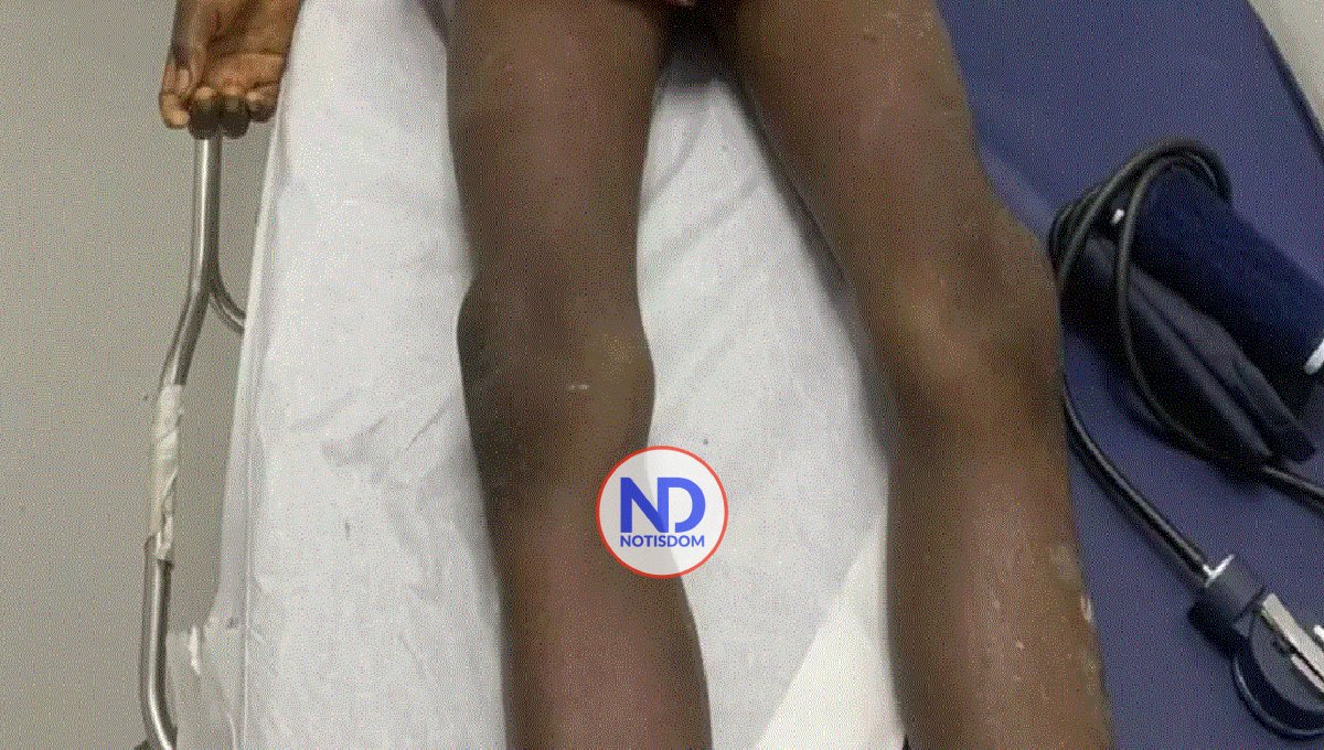 Menor muere tras disparo de escopeta