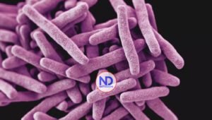 Perú iniciará tratamiento de tuberculosis resistente con nuevo medicamento