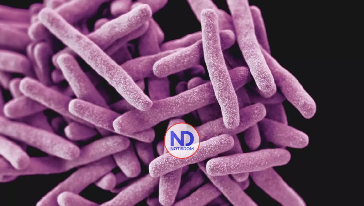 Perú iniciará tratamiento de tuberculosis resistente con nuevo medicamento