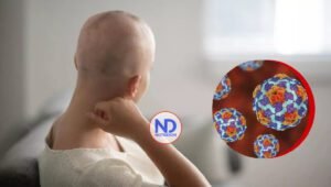 Descubren que tumor puede ser causado por virus