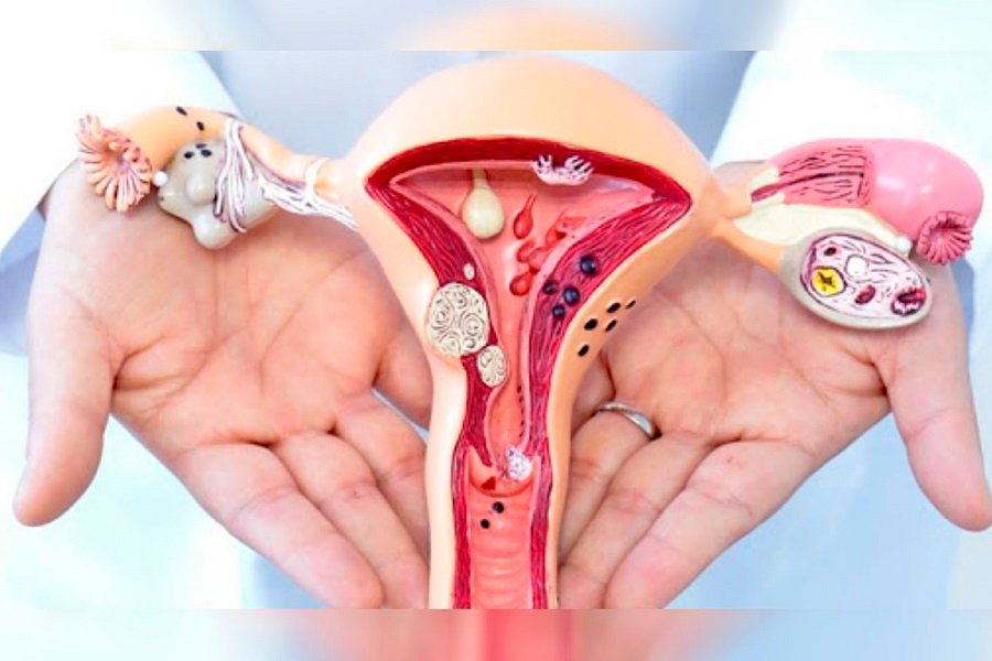 utero 3 Vacunas contra VPH proponen un futuro libre de cáncer de cuello uterino