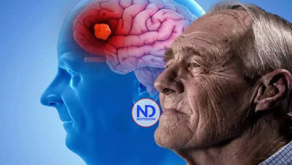 Contaminación del aire está vinculada con el alzhéimer, según un estudio de EE.UU.