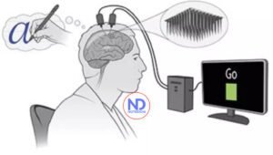 Científicos desarrollan una interfaz cerebro-computadora inalámbrica poco invasiva