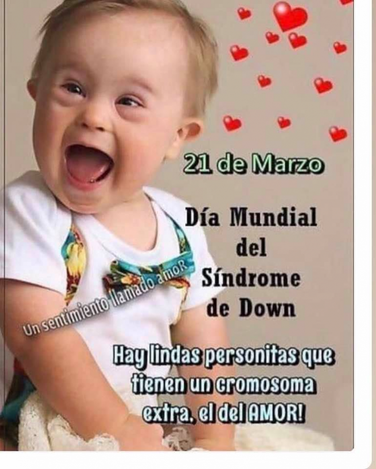 Bendito Síndrome de Down 3 Sindrome de Down Bendito Síndrome de Down
