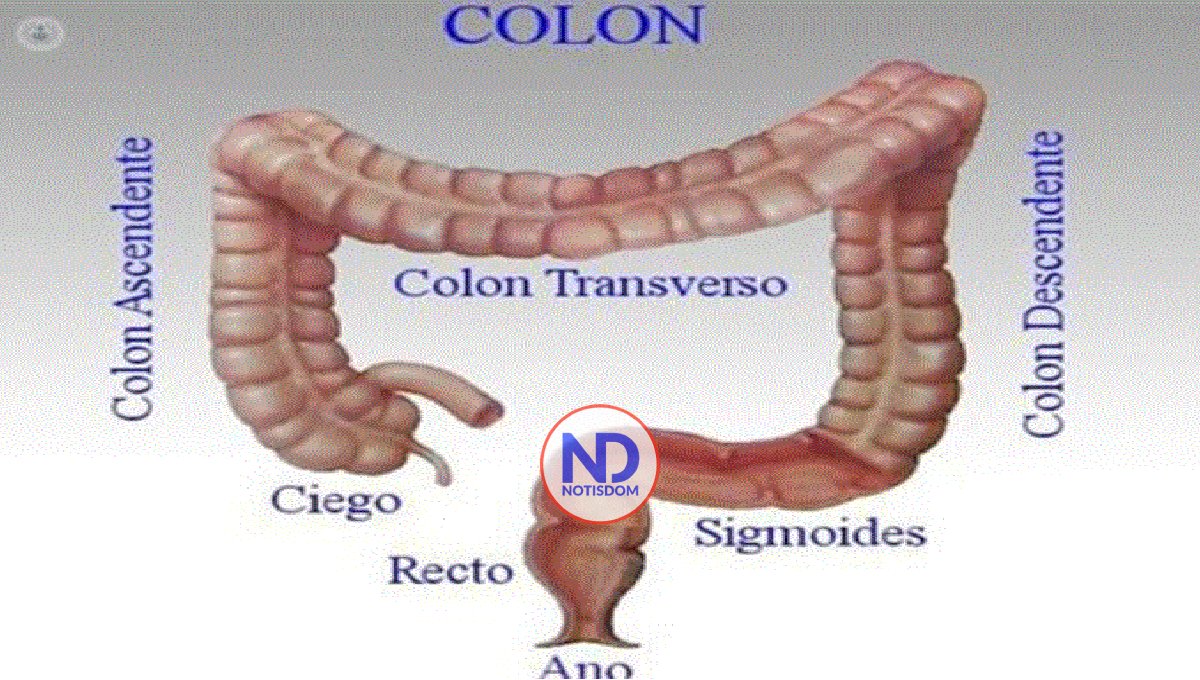 Cáncer colorrectal afecta a las personas menores de 30 años 2 Cáncer colorrectal afecta a las personas menores de 30 años