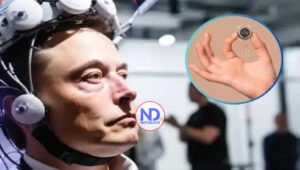 Blindsight, el chip cerebral con el que Elon Musk busca restaurar la visión a personas ciegas