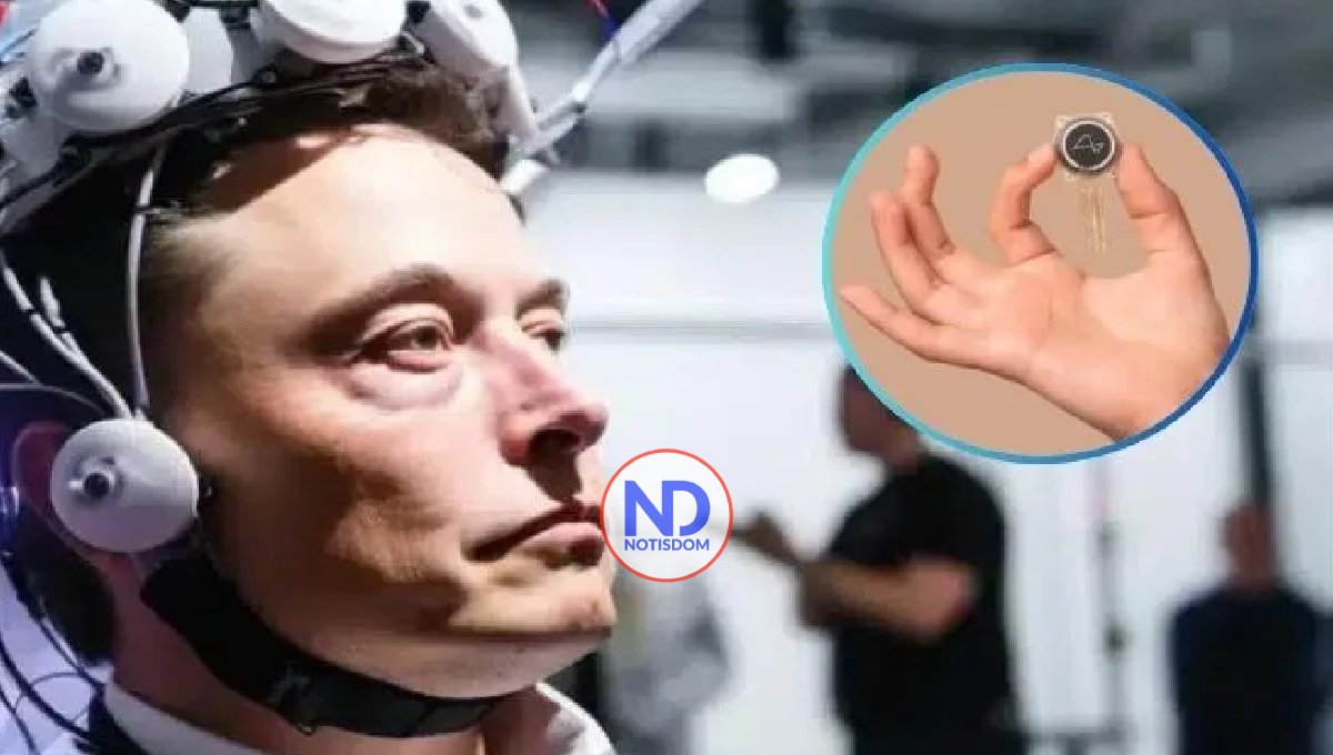 Blindsight, el chip cerebral con el que Elon Musk busca restaurar la visión a personas ciegas