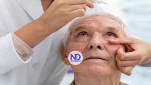 El glaucoma es una amenaza silenciosa para la visión