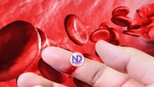 Niños con hemofilia reciben tratamiento por más de RD$37 millones