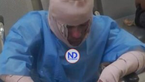 Continúa prófuga mujer que roció gasolina y prendió fuego a su pareja en Los Ríos