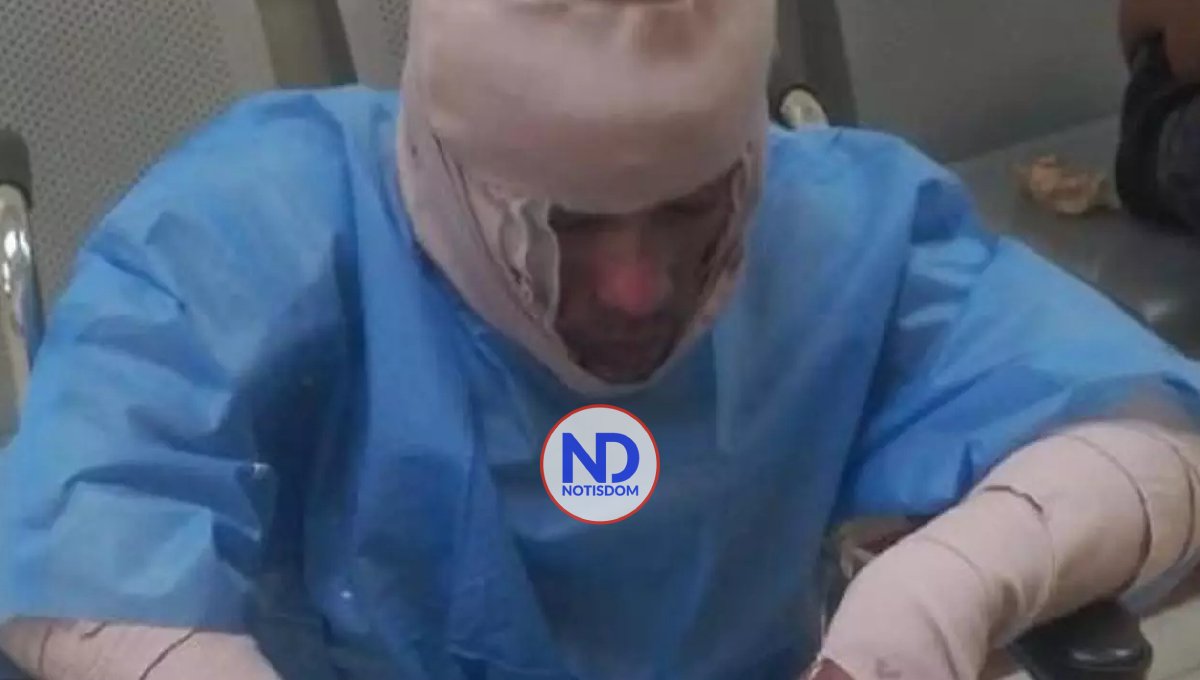 Continúa prófuga mujer que roció gasolina y prendió fuego a su pareja en Los Ríos