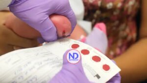 Importancia de la prueba de tamizaje neonatal