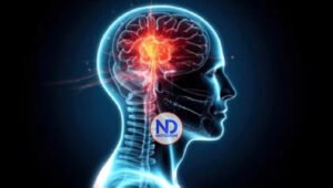 Consumo de cerdo podría relacionarse con una infección parasitaria en el cerebro