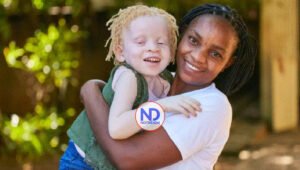 Día Internacional de Sensibilización sobre el Albinismo