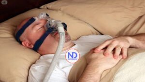 Estudio identifica primer tratamiento farmacológico para la apnea del sueño