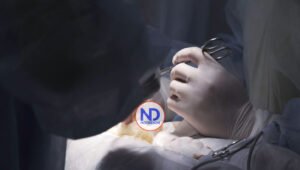 ¿Qué beneficios tiene la circuncisión en los hombres?