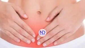 ¿Qué es y cuáles son los síntomas de la Miomatosis uterina o fibromas?