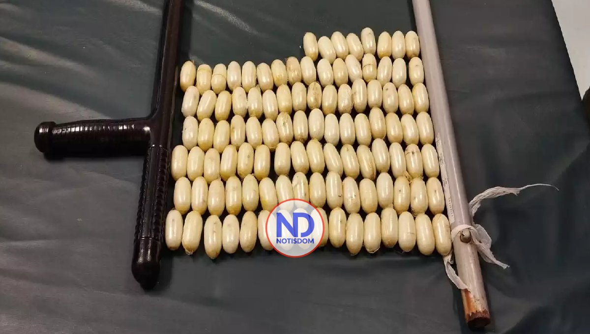 Arrestan extranjero con 104 bolsitas de presunta cocaína en el estómago 2 Arrestan extranjero con 104 bolsitas de presunta cocaína en el estómago