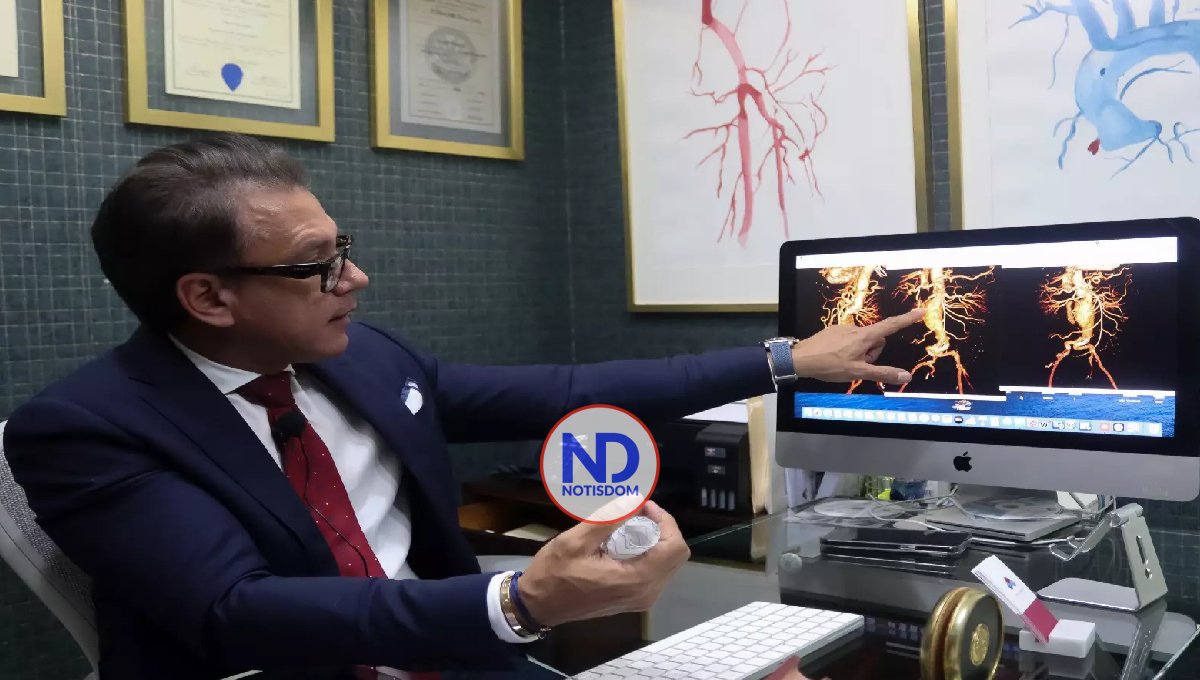 Cirujano dominicano realiza primer procedimiento del país para eliminar aneurisma aorta 2 Cirujano dominicano realiza primer procedimiento del país para eliminar aneurisma aorta