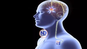 Un «marcapasos en el cerebro»: Revolucionando el tratamiento de la enfermedad de Parkinson