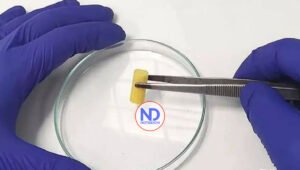 Descubren la causa de la reaparición del tumor linfático y su resistencia terapéutica