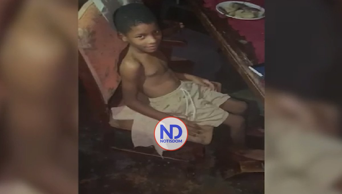 Solicitan ayuda para operar niño con parálisis cerebral 2 Solicitan ayuda para operar niño con parálisis cerebral