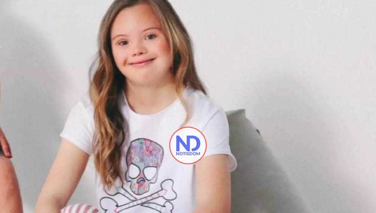 Explican por qué los niños con síndrome de Down tienen más riesgo de padecer leucemia 2 Explican por qué los niños con síndrome de Down tienen más riesgo de padecer leucemia