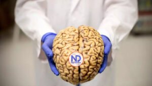 Nuevos avances para detectar el alzhéimer