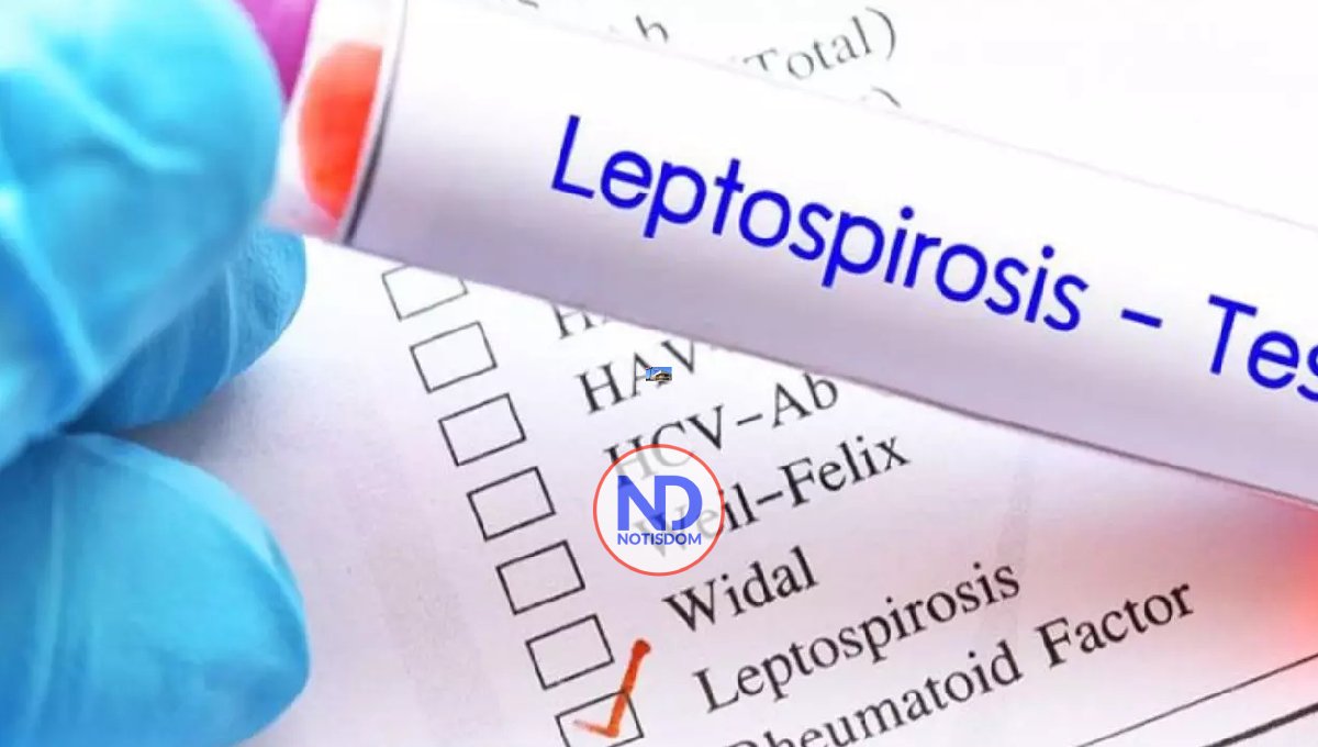 ¿Qué es la leptospirosis y cómo prevenirla? 2 ¿Qué es la leptospirosis y cómo prevenirla?