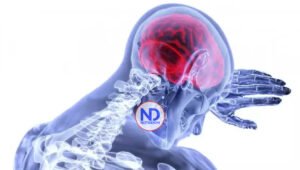 Identifican las células que facilitan la metástasis cerebral