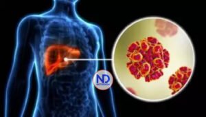 Hepatitis B y C continúan expandiéndose en el país