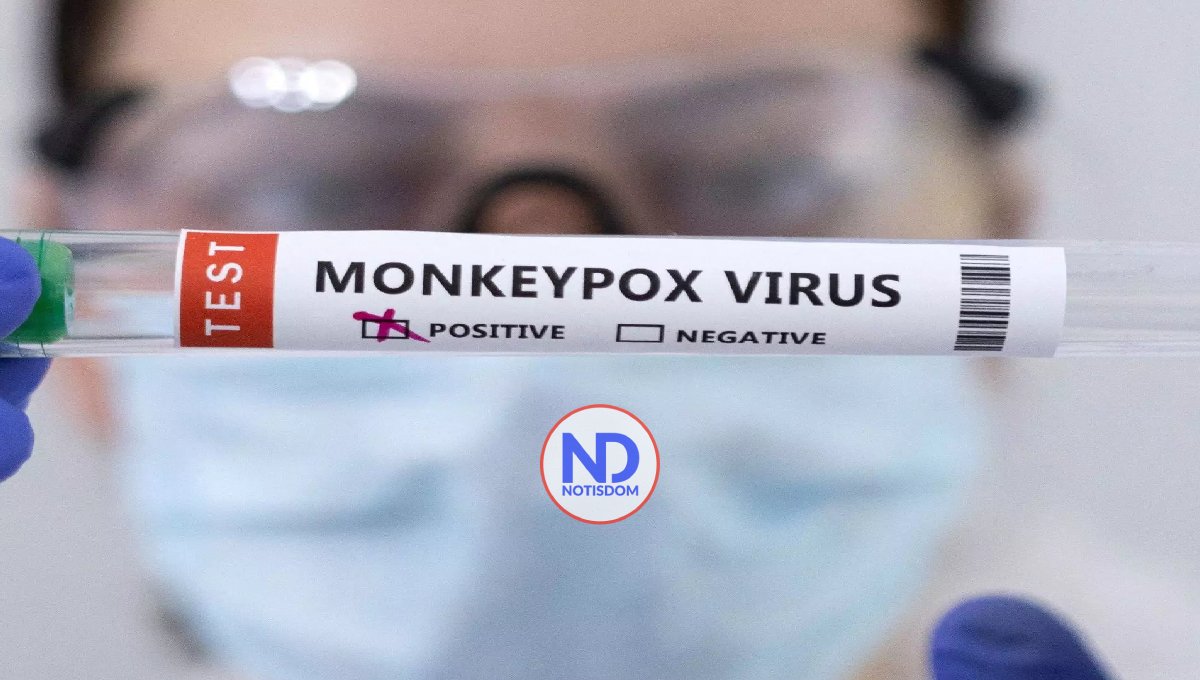 La OMS aprueba el uso de emergencia de una prueba diagnóstica para detectar el mpox