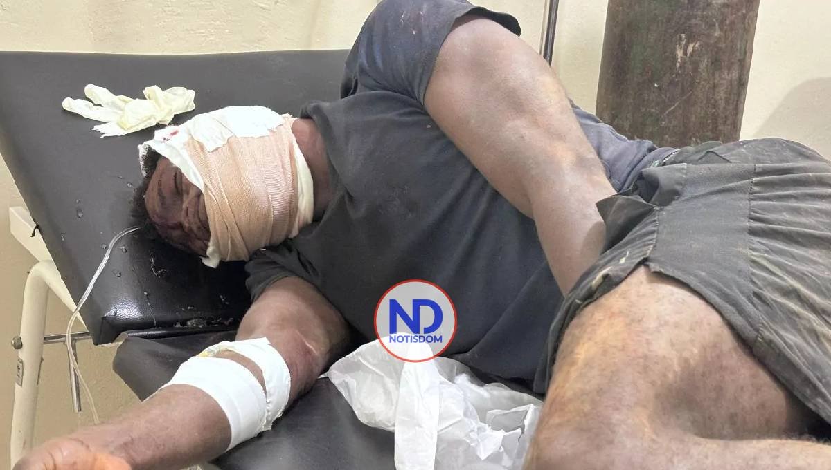 Comunitarios atacan con arma blanca a hombre acusado de brechar y violar mujeres en Yamasá