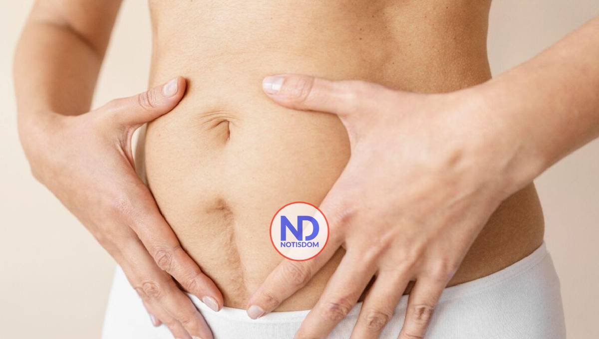 Mujeres experimentan diástasis de recto abdominal tras el parto