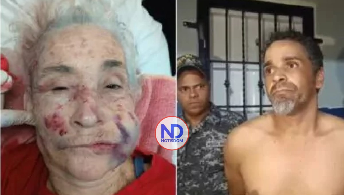 Policía captura a hombre acusado de golpear brutalmente a mujer de 74 años en Moca