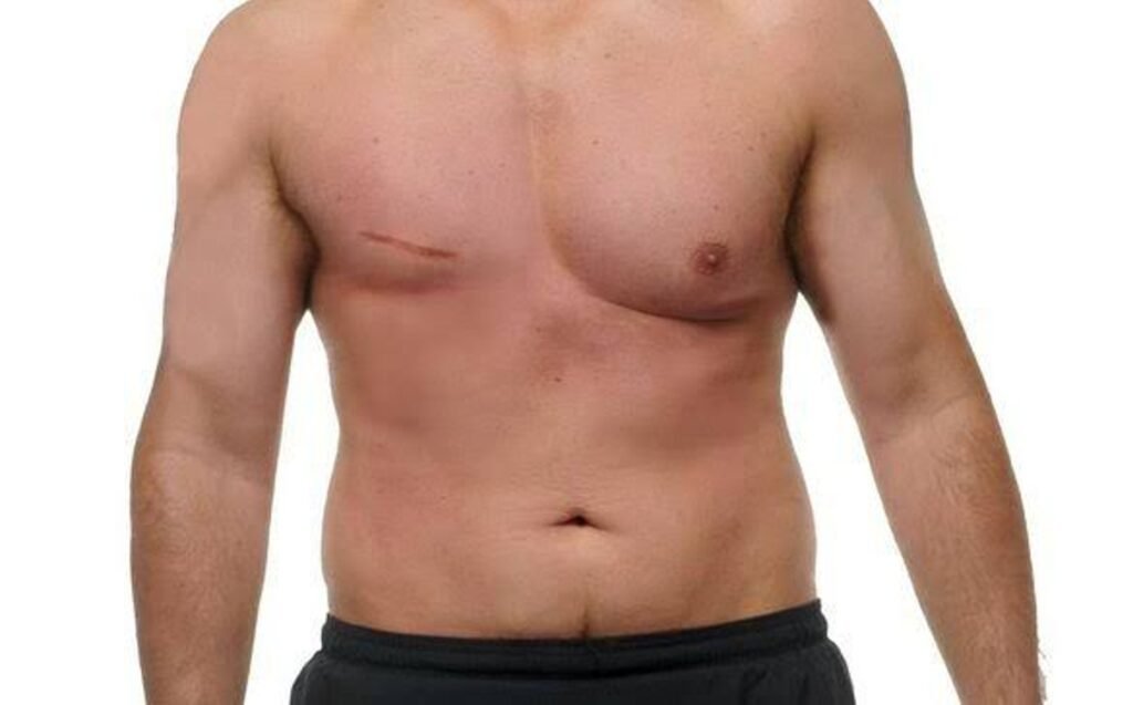 "Tócate para que no te toque", el cáncer de mama también afecta a los hombres 3 hombre 15 "Tócate para que no te toque", el cáncer de mama también afecta a los hombres